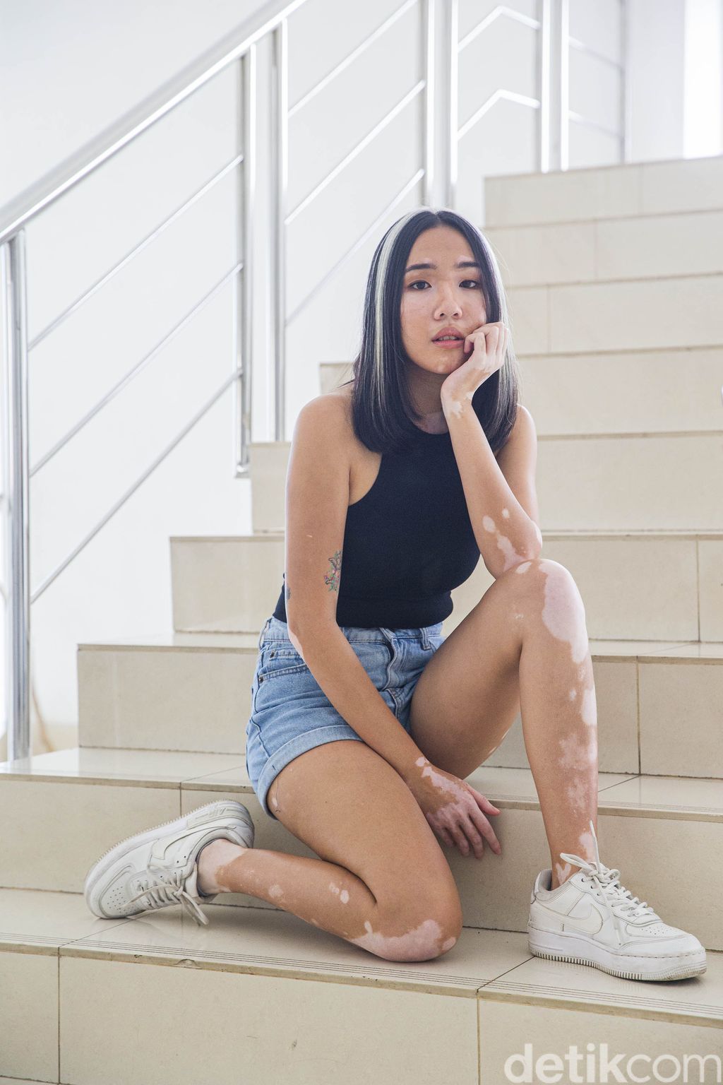 Model Vitiligo Zsazsa Caesar