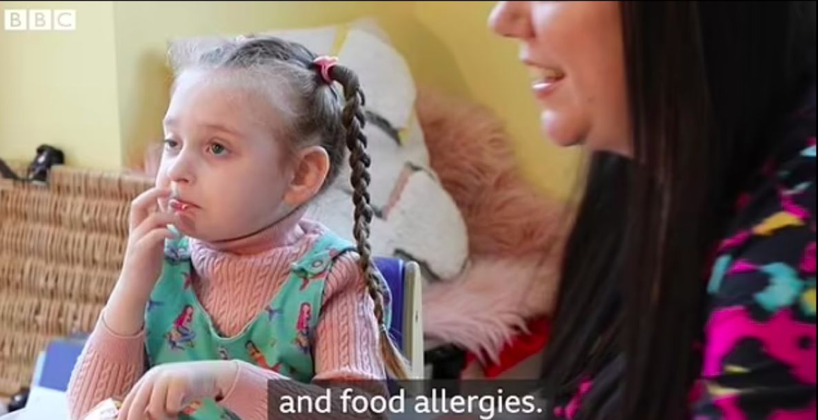 Alami Gangguan Makan, Bocah 4 Tahun Hanya Bisa Makan Keripik Tiap Hari