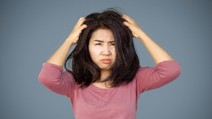 Asian woman hair having problem with dandruff hand itching her dry skin on head
