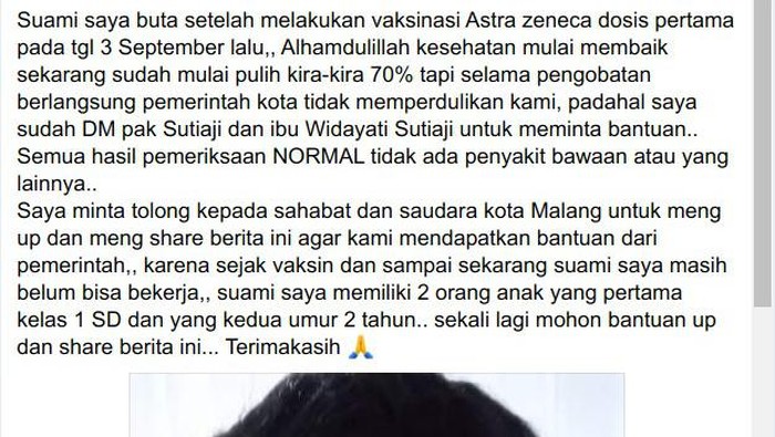 viral buta usai divaksin astrazeneca