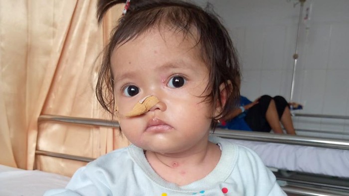 Bayi Eliza menderita kelainan kulit langka (campaign donasi BerbuatBaik)