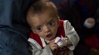 Di Rumah Sakit Anak Ataturk Kabul, bangsal gizi buruk dipenuhi dengan anak-anak kurus. Dengan terputusnya pembiayaan asing, banyak fasilitas kesehatan di seluruh negeri juga telah ditutup, sehingga semakin sulit bagi warga Afghanistan untuk mendapatkan perawatan medis.