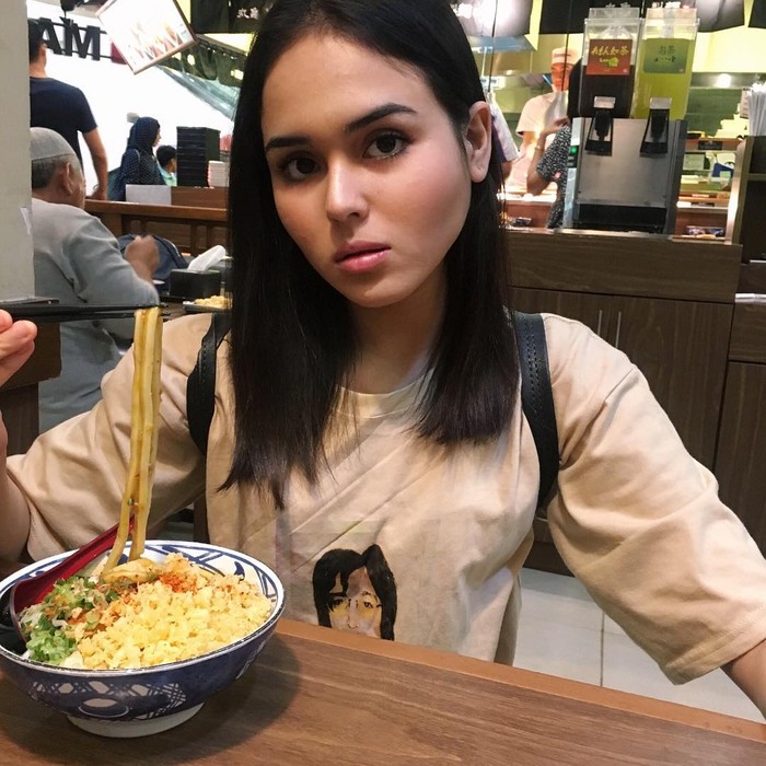 Laura Anna Tuntut Tanggung Jawab Gaga Muhammad Atas Kecelakaan yang Membuatnya Lumpuh