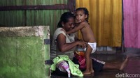 Diketahui sebanyak 6.674 atau 22,3 persen Balita di Kabupaten Kupang mengalami masalah gizi atau stunting.