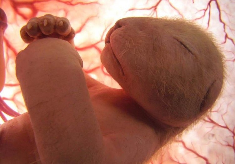 fotoinet penampakan hewan dalam rahim