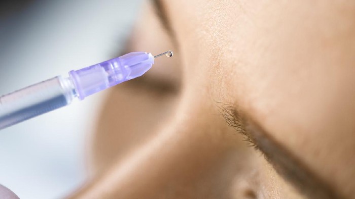 Girl receiving hyaluronic acid treatment