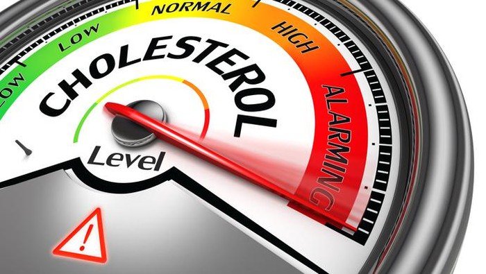 Level kolestrol Cholesterol test