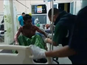 Puskesmas Overload, Korban Luka Bakar Semeru Erupsi Terus Berdatangan