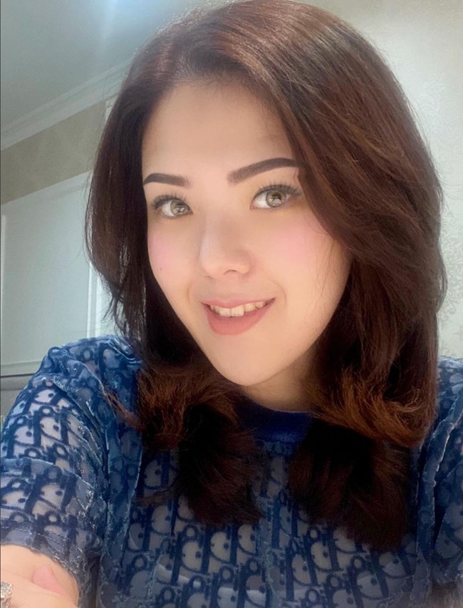 Tina Toon sendiri belum menanggapi komentar netizen terkait dugaan operasi plastik.Foto: Instagram/@tinatoon101
