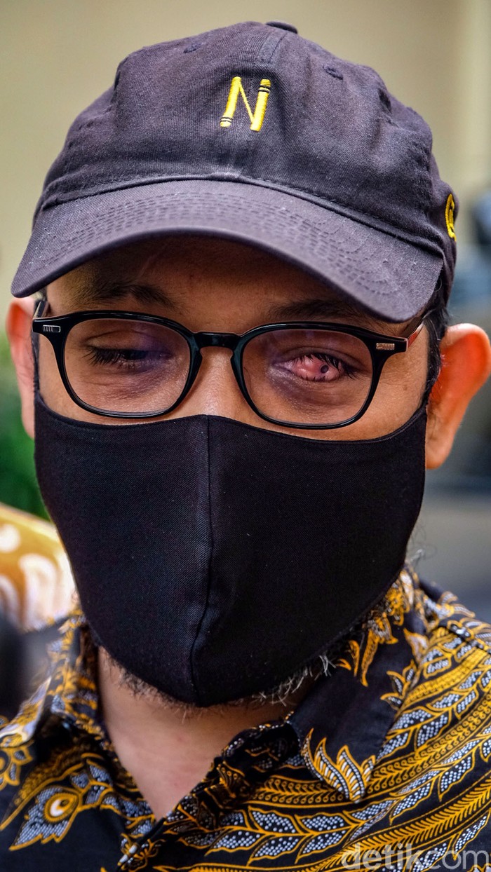 Sebanyak 52 eks pegawai KPK mengikuti sosialisasi pengangkatan ASN Polri hari ini. Novel Baswedan ikut serta ikut sosialisasi.