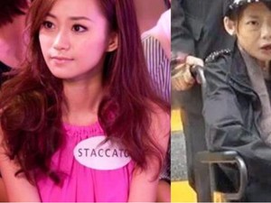 Mengenal Adhesi Usus, Diidap Supermodel yang Kondisinya Kini Mengenaskan