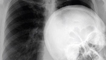 Ada yang ngintip-ngintip nih. (Foto: Brightside)