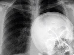 Ngilu! Begini Potret Hasil Sinar X Ray di Dalam Tubuh