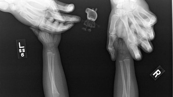 Putriku menolak untuk melakukan X-ray tanpa Peppa Pig (boneka), kata ayah gadis yg dipindai ini. Foto: Brightside