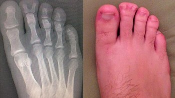 Coba perhatikan bagian telunjuk kakinya. (Foto: Brightside)