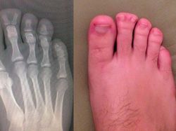 Ngilu! Begini Potret Hasil Sinar X Ray di Dalam Tubuh