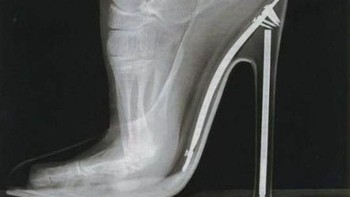 Beginilah tulang kaki wanita ketika menggunakan sepatu hak tinggi. (Foto: Brightside)