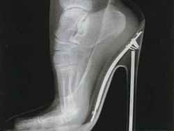 Ngilu! Begini Potret Hasil Sinar X Ray di Dalam Tubuh