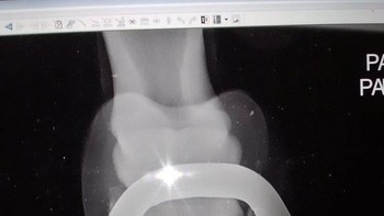 Penasaran bagimana hasil sinar X kaki kuda? begini hasilnya. (Foto: Brightside)