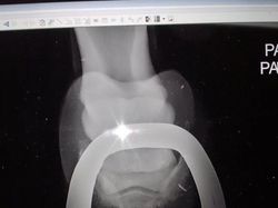 Ngilu! Begini Potret Hasil Sinar X Ray di Dalam Tubuh