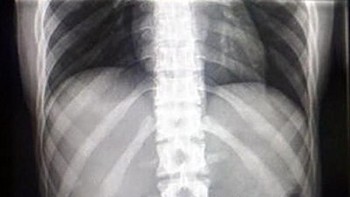 Cincinnya kok malah ditelan ya? (Foto: Brightside)