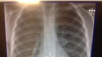 Menelan kepingan salju. (Foto: Brightside)