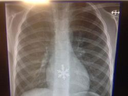 Ngilu! Begini Potret Hasil Sinar X Ray di Dalam Tubuh