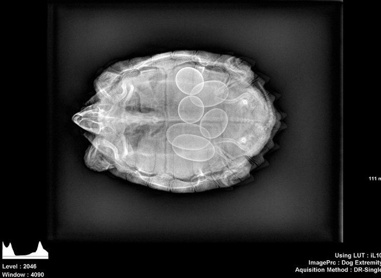 fotoinet hasil sinar x manusia fotoinet hasil sinar x manusia