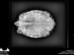 Ngilu! Begini Potret Hasil Sinar X Ray di Dalam Tubuh