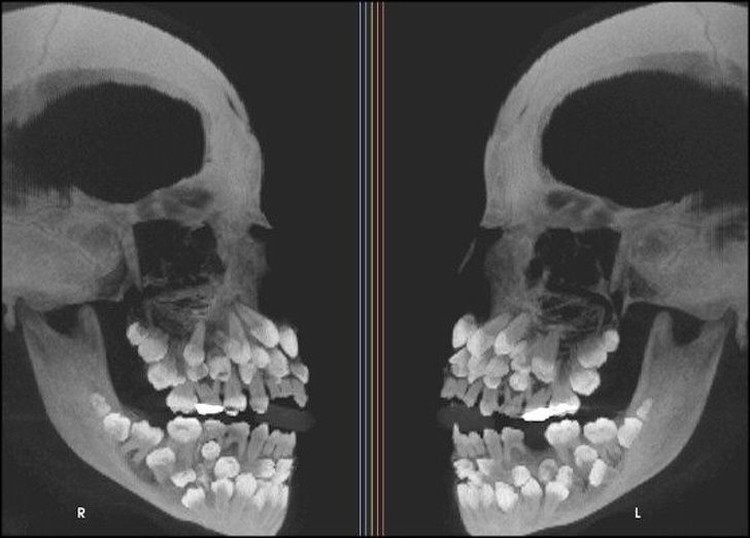 fotoinet hasil sinar x manusia fotoinet hasil sinar x manusia