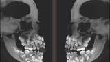 Ngilu! Begini Potret Hasil Sinar X Ray di Dalam Tubuh