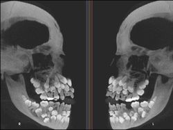 Ngilu! Begini Potret Hasil Sinar X Ray di Dalam Tubuh