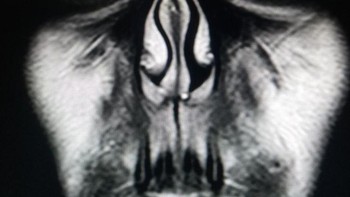 Hiiiii, ini adalah hasil MRI pada wajah. (Foto: Brightside)