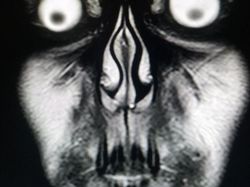 Ngilu! Begini Potret Hasil Sinar X Ray di Dalam Tubuh