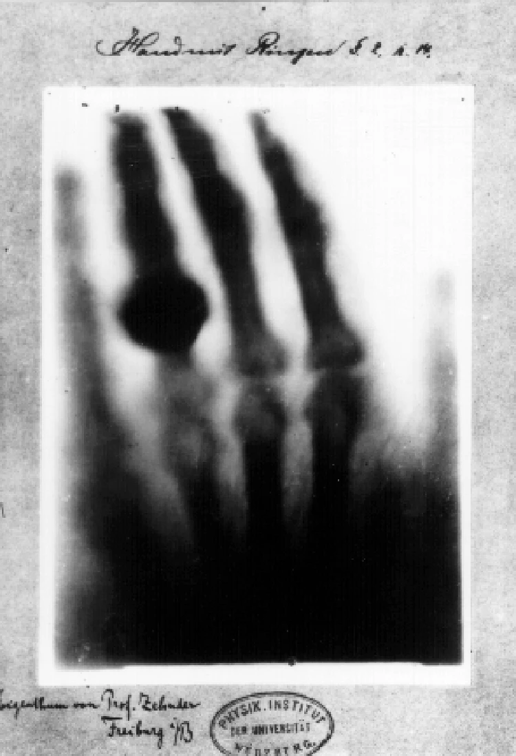 fotoinet hasil sinar x manusia