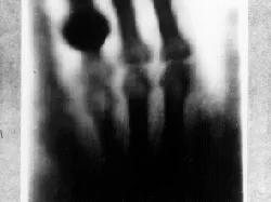 Ngilu! Begini Potret Hasil Sinar X Ray di Dalam Tubuh