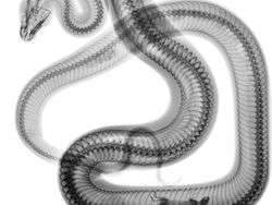 Ngilu! Begini Potret Hasil Sinar X Ray di Dalam Tubuh