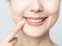 Hari Kesehatan Gigi dan Mulut, Ini Pentingnya Periksa Gigi 6 Bulan Sekali