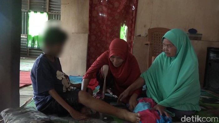 Seorang bocah laki-laki di Sulbar menderita penyakit hingga membuat perutnya membuncit layaknya wanita hamil. Kondisi Bernis membuat pihak keluarganya takut. (Abdy/detikcom)