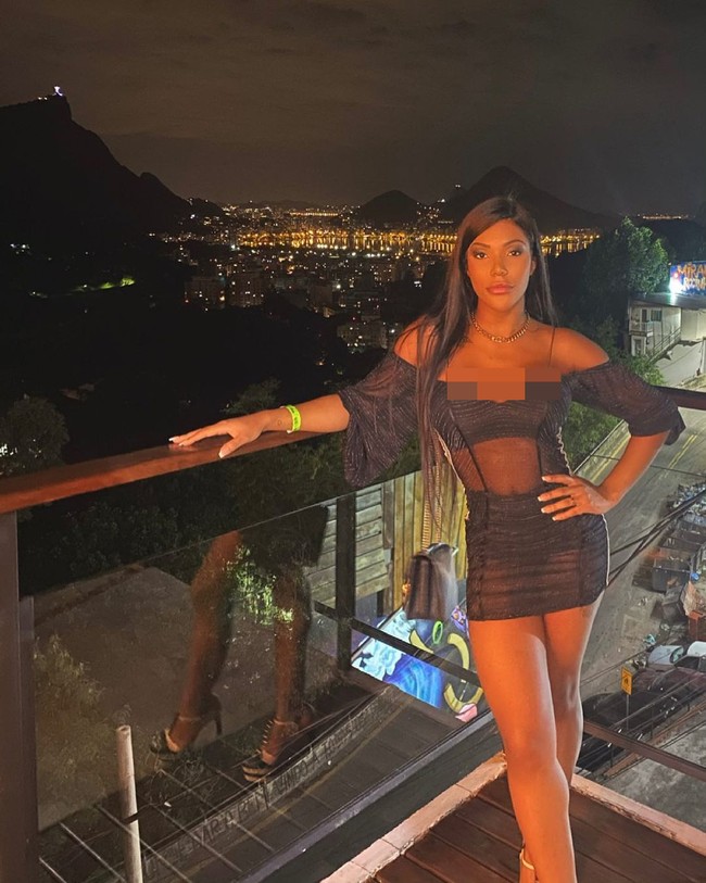 Dikatakan Ana telah mengeluarkan $150 ribu atau sekitar Rp 2 miliaran untuk berbagai prosedur di wajah juga tubuhnya.Foto: Instagram @carolekker