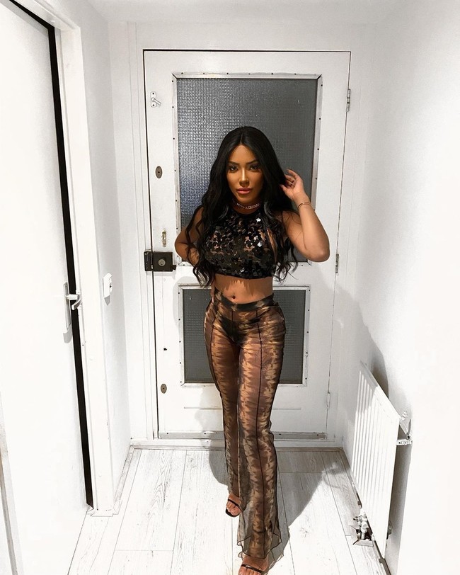 Beberapa tindakan yang pernah dilakukannya, antara lain empat operasi hidung, sedot lemak, pembesaran bokong bio-plasty, bichectomy atau pembuangan lemak wajah, hingga tindakan harmonisasi wajah.  Foto: Instagram @carolekker