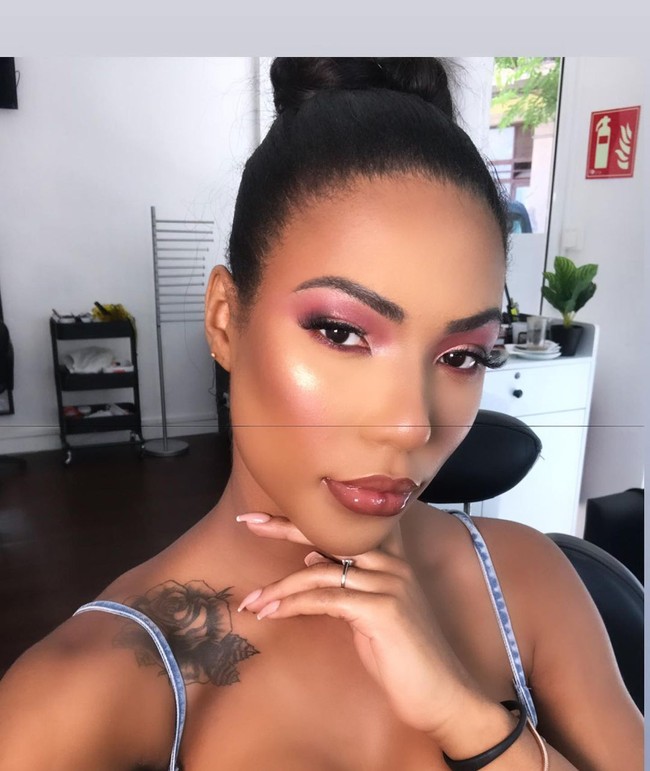  Di Instagram, wanita tersebut tidak ragu untuk menunjukkan proses atau luka operasi plastiknya. Foto: Instagram @carolekker