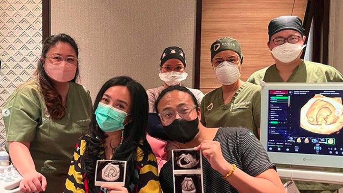 Dea Ananda hamil anak pertama.