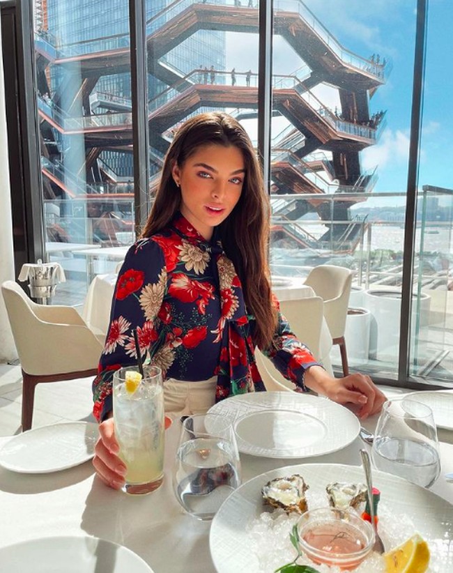 Dia lahir dengan kondisi tortikolis bawaan, yakni kelainan yang membuat kepala dan lehernya menjadi miring. Dia telah menjalani operasi sejak masih kecil. Nadia mengenang ketika berusia 10 tahun dia berada di ambang kematian karena operasi tersebut.  Foto: dok. Instagram/@nadiatferreira