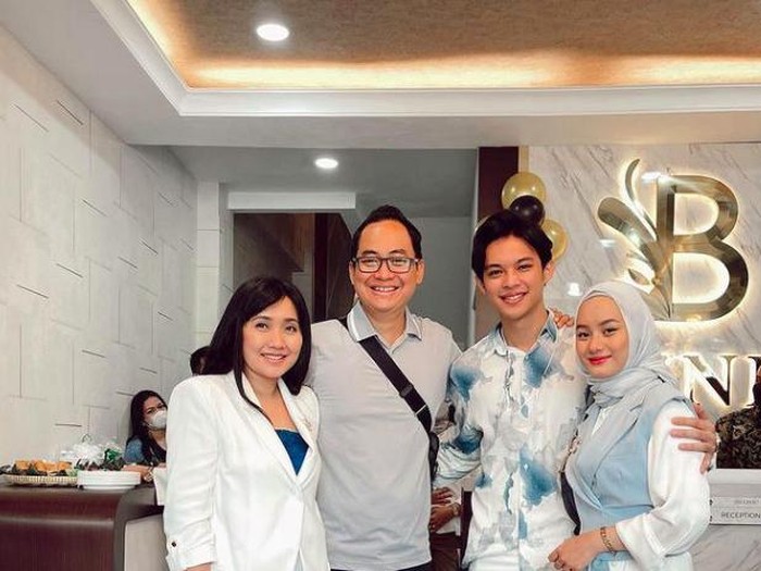Rey Mbayang yang diberi kejutan oleh Dinda Hauw.