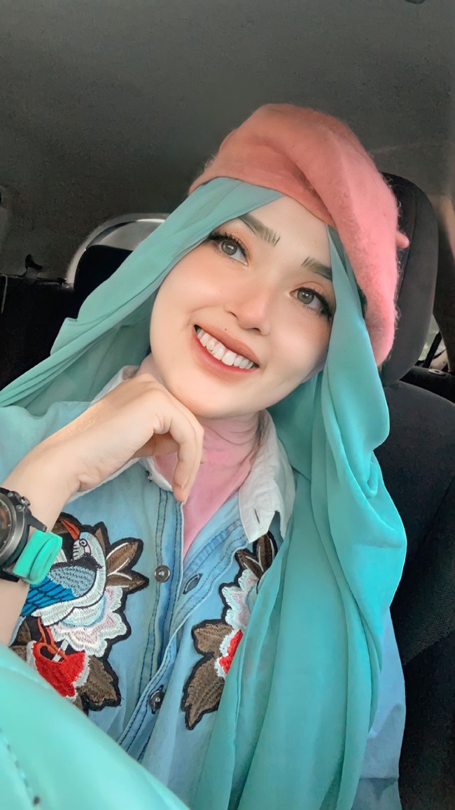 Eis menjawab pertanyaan warganet soal nose up atau alat pemancung hidung yang dipakainya di video TikToknya. Menurutnya alat tersebut membantu agar hidung terlihat mancung tanpa filter. Hanya menginspirasi buat wanita kalau kita itu nggak perlu filler, bisa dibantu dengan make up. Dan ada alat yang bisa kita gunakan seperti nose up. Kalau aku sendiri hanya hanya buat foto buat video TikTok atau undangan tapi kalau sehari-harinya nggak sih aku nggak pakai, ungkap Eis kepada Wolipop lewat Whatsapp, Kamis (16/12/2021). Foto: Dok. pribadi Eis.