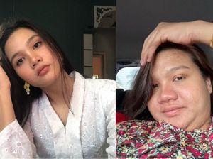 Beda Banget! Perubahan Wajah Wanita Ini saat Hamil Sampai Bikin Tak Dikenali