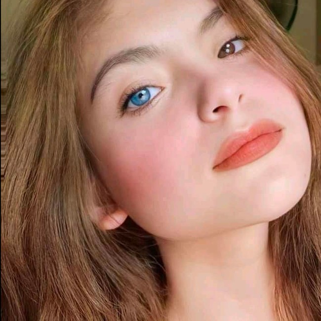 Julia memiliki pupil mata berwarna coklat pada bagian kanan, dan biru pada mata bagian kirinya. Pada dunia medis, kasus yang dialami oleh remaja asal Bacolod, Filipina ini disebut sebagai kelainan pada mata yang sering disebut heterochromia. Foto: dok. Facebook