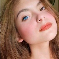 Julia memiliki pupil mata berwarna coklat pada bagian kanan, dan biru pada mata bagian kirinya. Pada dunia medis, kasus yang dialami oleh remaja asal Bacolod, Filipina ini disebut sebagai kelainan pada mata yang sering disebut heterochromia. Foto: dok. Facebook