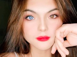 8 Foto Julia Ostan, Model Bermata Beda Warna yang Foto Pribadinya Tersebar